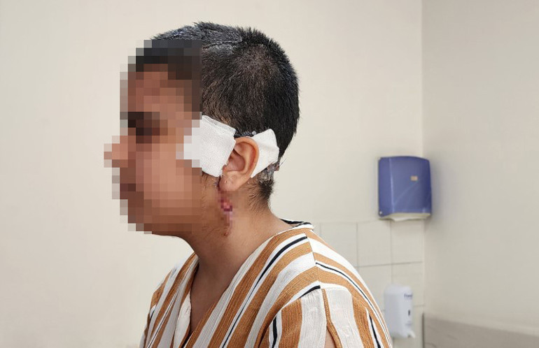 Go-kart pistinde facia Kız çocuğu ölümden döndü; saç derisi saatler süren ameliyatla dikildi