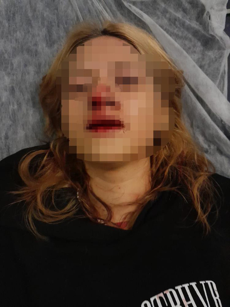 Bunları yapan çocuk Yüzüne kaldırım taşı attılar, kulağını yardılar