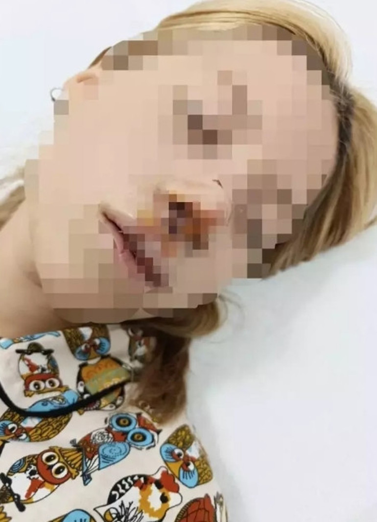 Sultangazide yüzüne kaldırım taşı atılan öğrenci yaşadığı dehşeti anlattı