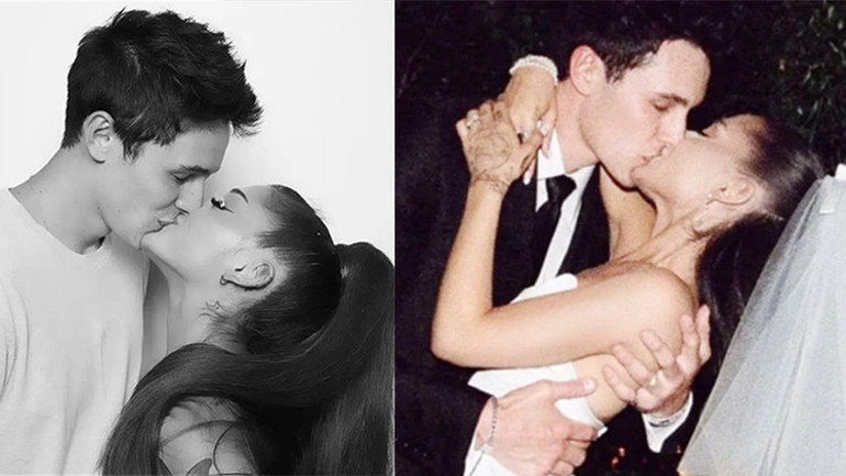 Genç yaşta yaptırdığı estetiklerden pişman… Gözyaşlarına boğuldu: Yıllarca bunların ardına saklanıp yaşadım