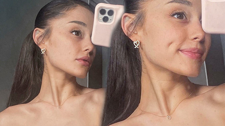 Genç yaşta yaptırdığı estetiklerden pişman… Gözyaşlarına boğuldu: Yıllarca bunların ardına saklanıp yaşadım