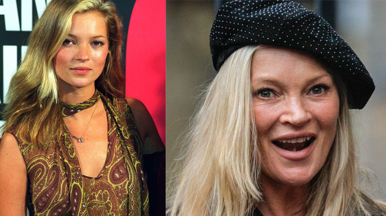 Som altından heykeli bile yapılmıştı... Yaşadığı hızlı hayat güzelliğini aldı: Efsaneler de çöker