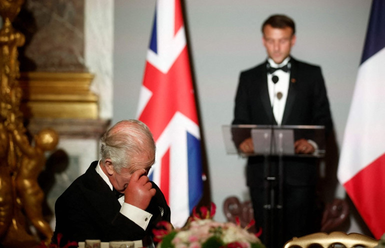 Fransa ziyaretine Kralın sosis parmakları damga vurdu İngiliz medyası doktorlara nedenini doktorlara sordu...