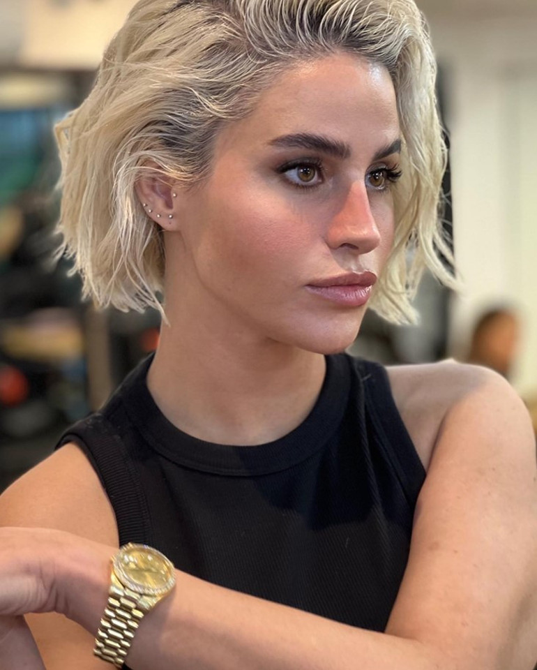 Yüzündeki değişim dikkat çekti... İşte yeni Ebru