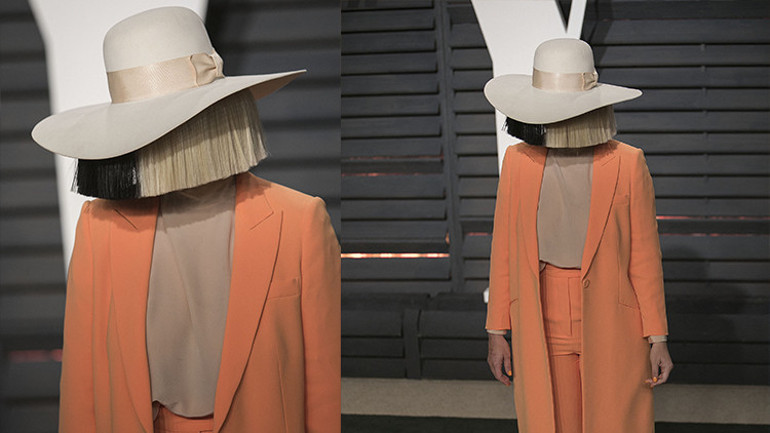 Ünlü şarkıcıdan estetik itirafı: Yıllardır kocaman peruklarla sakladığı yüzünü sonunda açtı