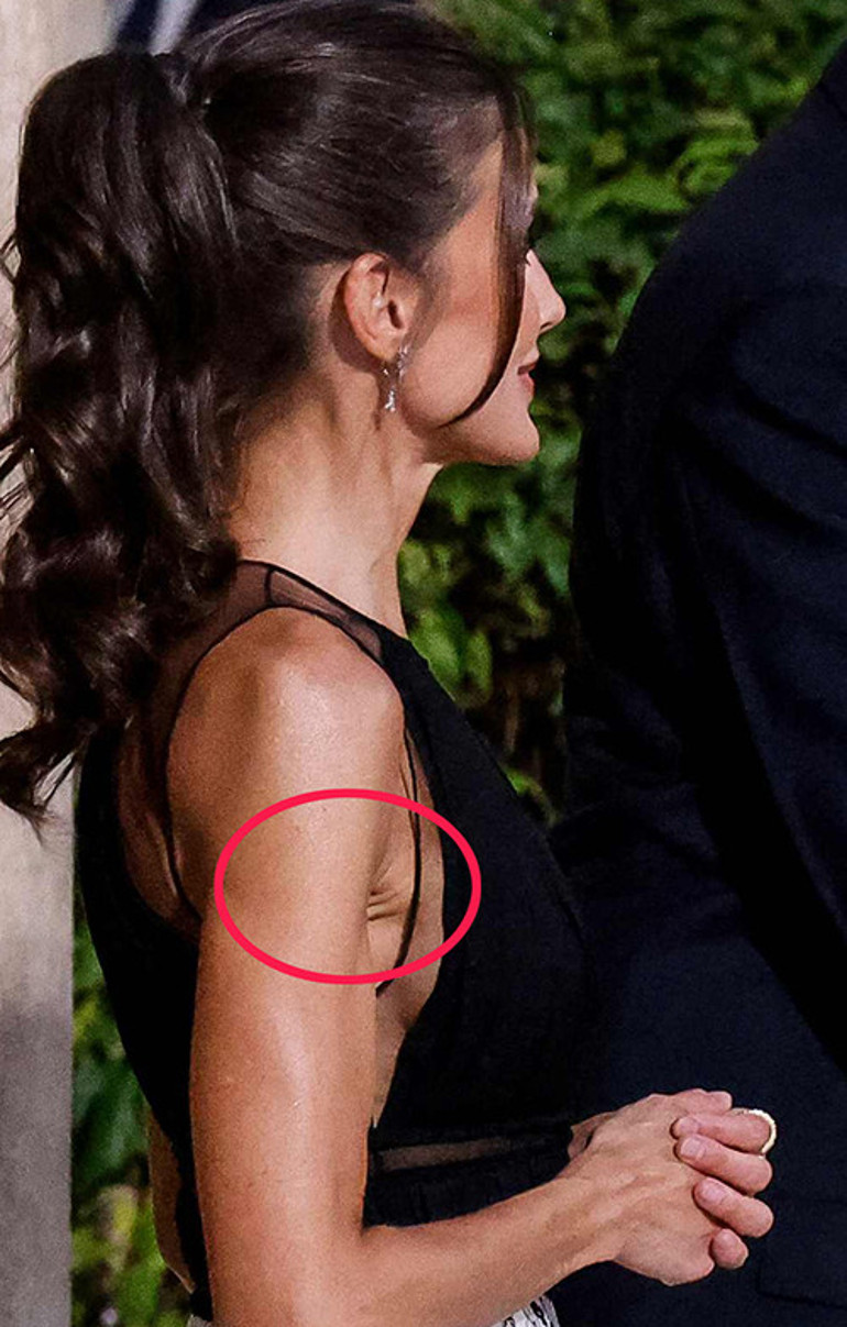Yüzünü çektir, kaldır, gerdir... Ama bunun çaresi yok: Keşke ütü olsaydı