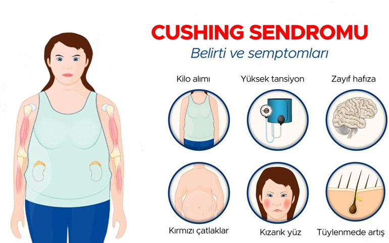 Diyet ve spora rağmen kilo veremeyenler buraya Altından hiç tahmin etmediğiniz bir hastalık çıkabilir