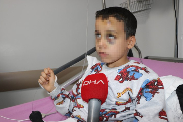 Yuvada bakıcı dehşeti Dövüp yere fırlattığı çocuğun kafatası kırıldı, gözleri morardı