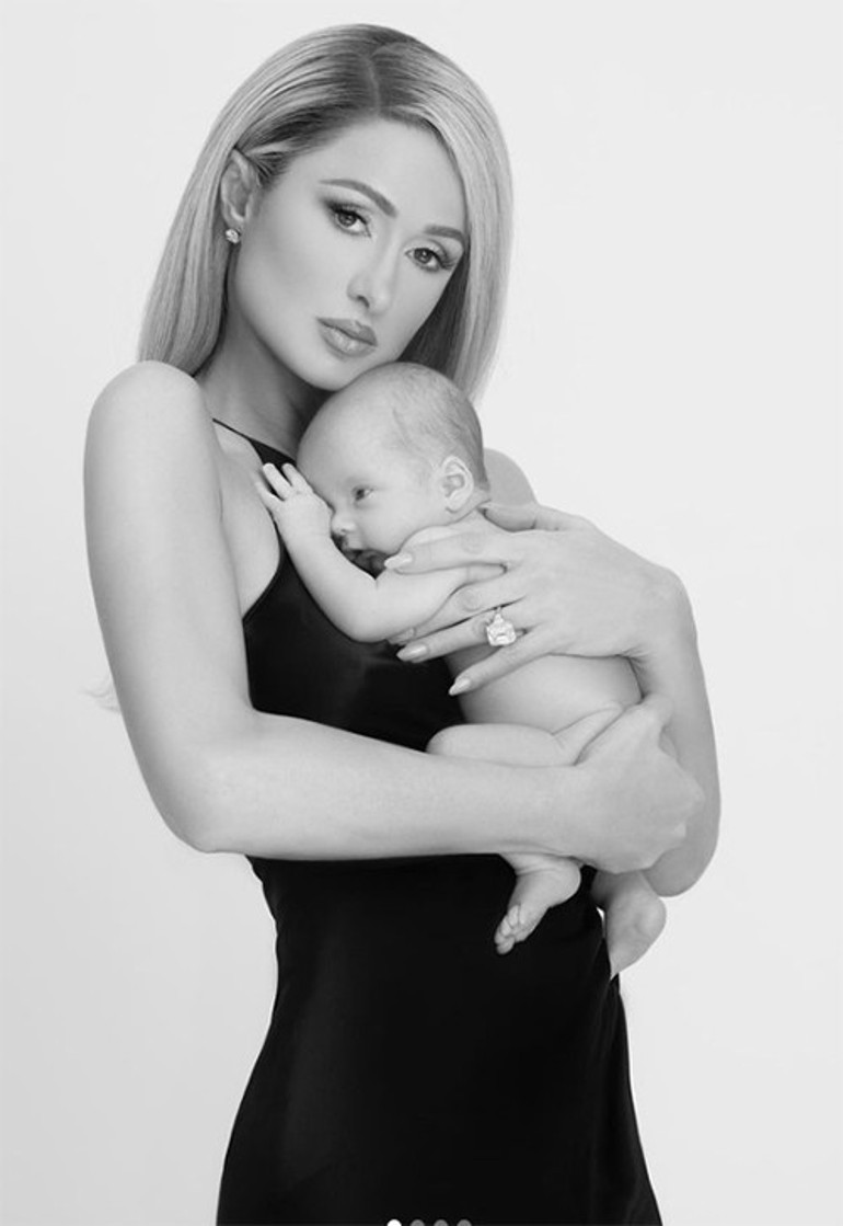 Kafası normalden büyük,  belki de hasta diyorlardı... Sosyetik güzel bebeğinin sağlık durumunu açıkladı