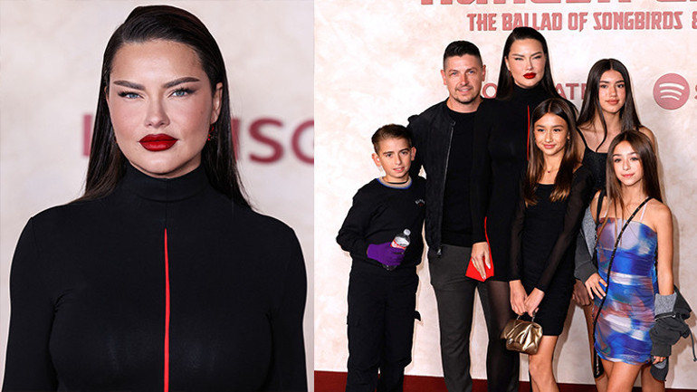 Estetik yaptırdığını söyleyenlere ateş püskürdü: Bu sadece yorgun bir annenin yüzü