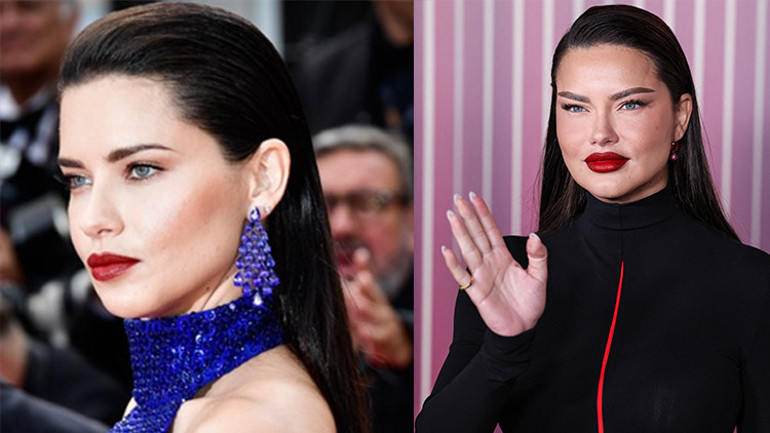 Estetik yaptırdığını söyleyenlere ateş püskürdü: Bu sadece yorgun bir annenin yüzü