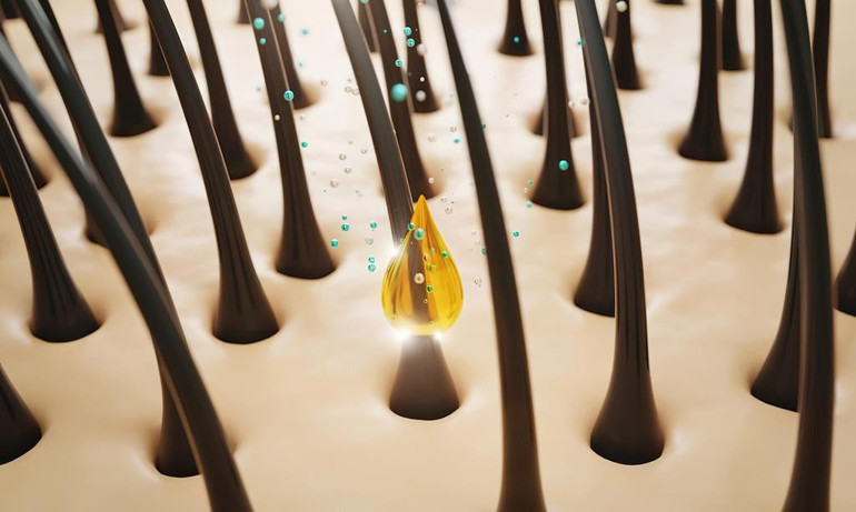 Saç dökülmesini önlemek mümkün mü