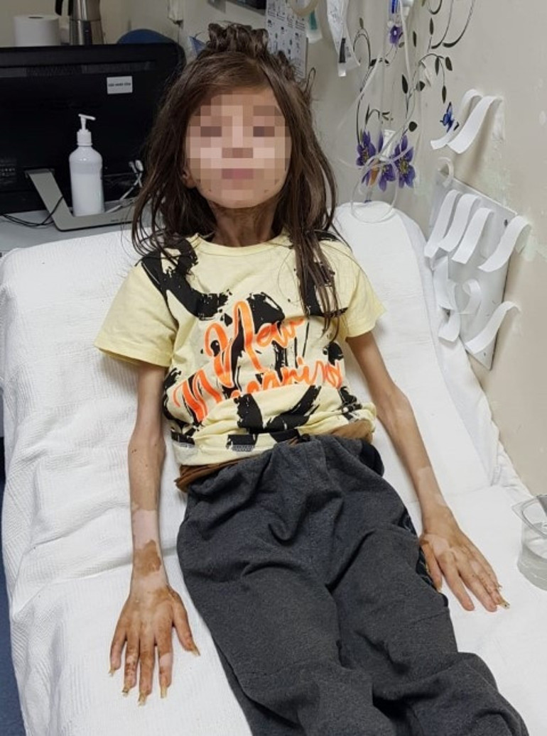 Teyzesi tarafından çöp evde esir tutulmuştu... Annesinden isim kararı: Hayatında sıkıntı yaşatan her şey temizlenecek