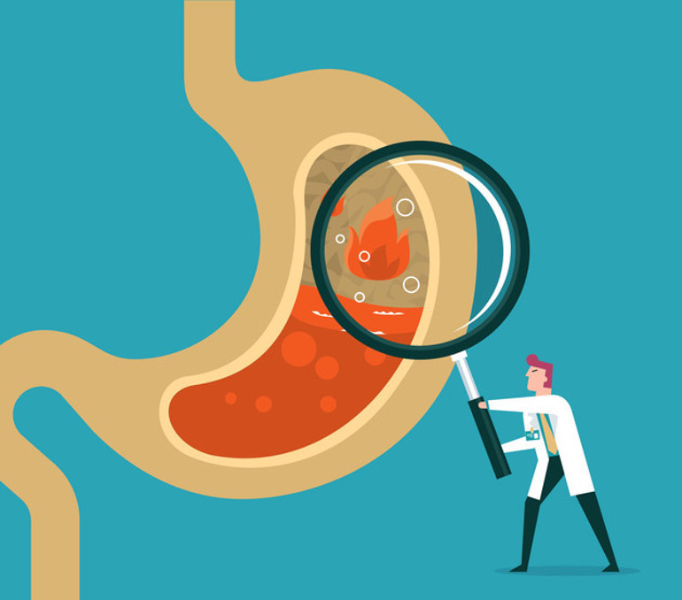 ‘Sessiz reflü’ sinsice ilerliyor Çok fazla çay ve kahve içenler dikkat ‘Ne hastaların ne de hekimlerin aklına geliyor’