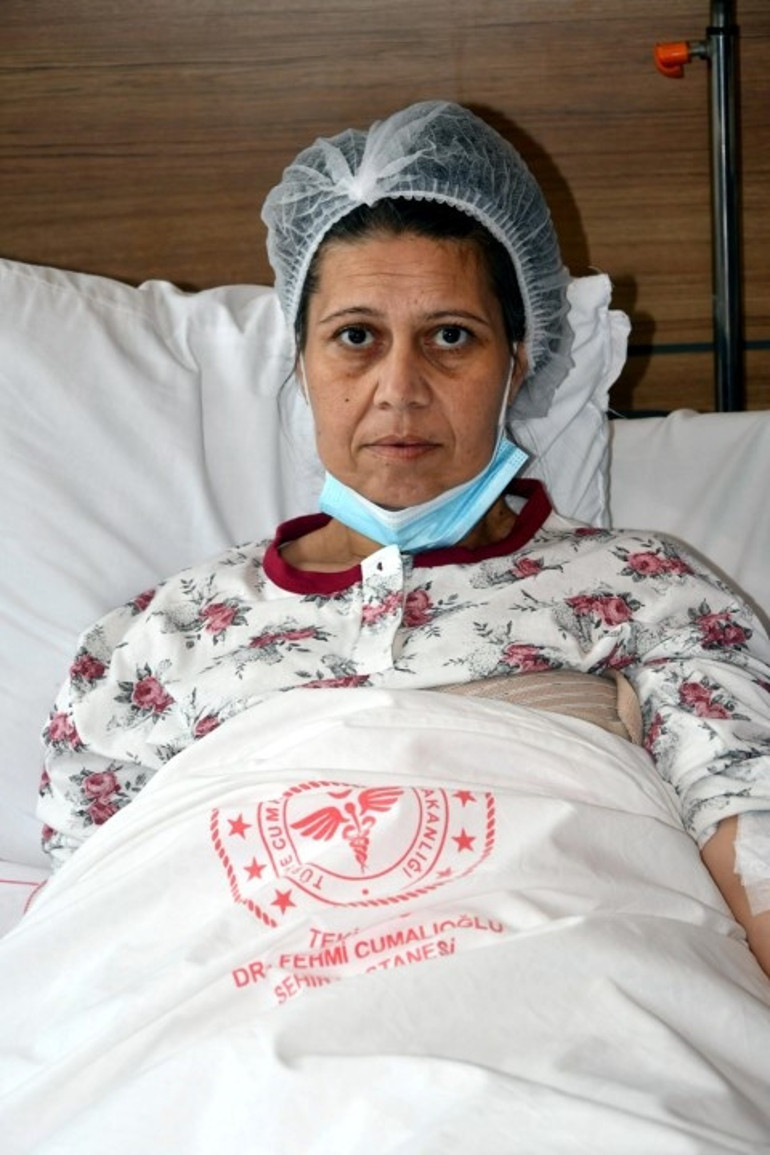 Karın şişliği için hastaneye gitti, gerçeği öğrenince şok oldu 50 santim çapında, 20 kilo ağırlığında: 1 saatlik ameliyatla alındı