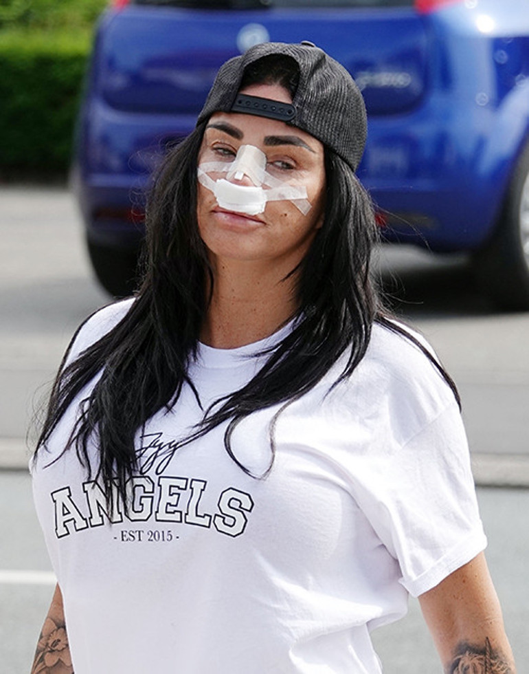 Estetik bağımlısı ünlü isim kendini durduramıyor... Bu uğurda iflas etti ama yine doktorun yolunu tuttu