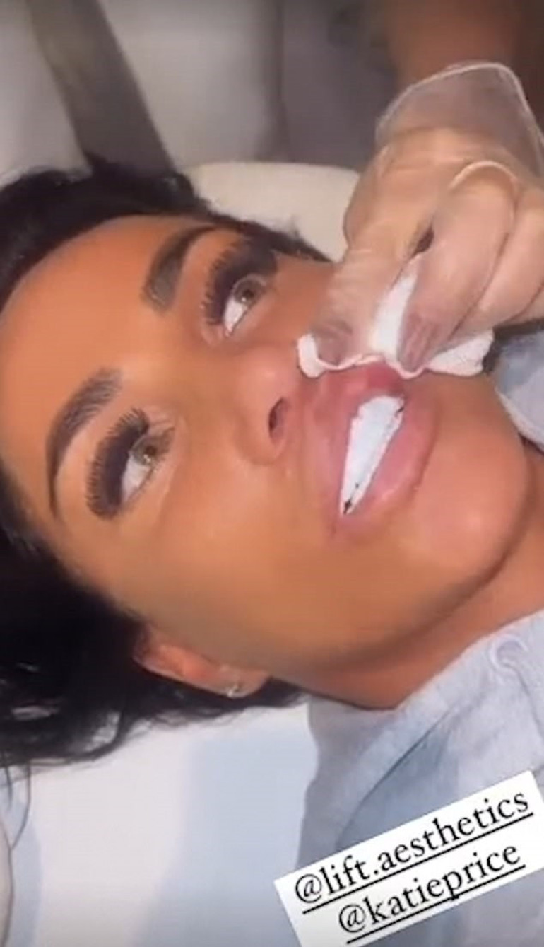 Estetik bağımlısı ünlü isim kendini durduramıyor... Bu uğurda iflas etti ama yine doktorun yolunu tuttu