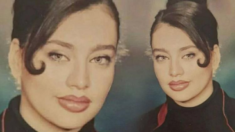 Umut Akyürek bıçak altına yattı: Alın daraltma ameliyatı geçirdim