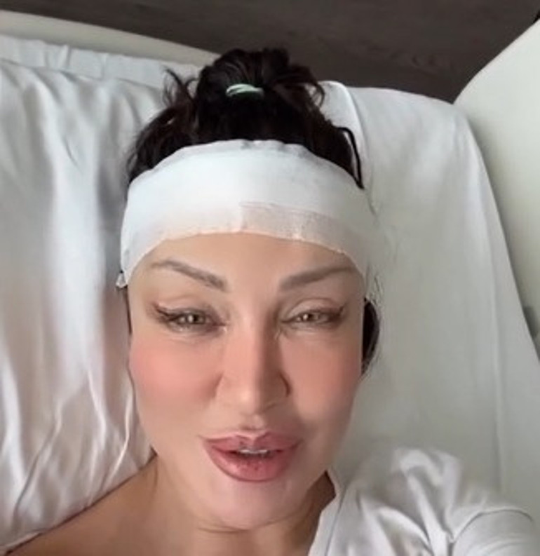 Umut Akyürek bıçak altına yattı: Alın daraltma ameliyatı geçirdim