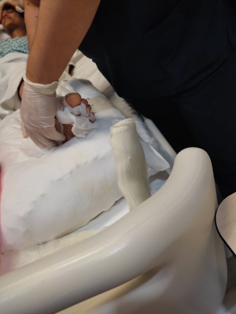 Gittiği bütün doktorlar kesilmek zorunda dedi... Mervenin bacağını yüzyılın cerrahı kurtardı Meslek hayatımda ilk kez görüyorum