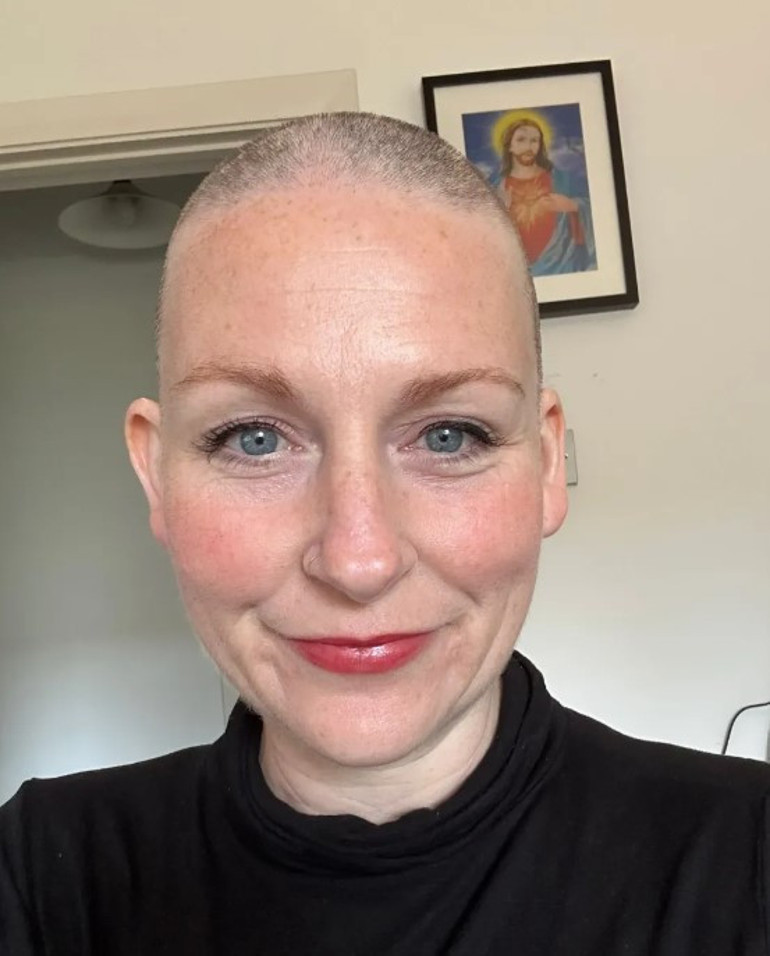 Doktorlar aylarca yanlış teşhis koydu, korkunç gerçeği Türkiyedeki hamamda fark etti