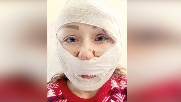 Hanna’nın kâbusu tahliye oldu... Falçatayla saldırmıştı, yüzü tanınmaz hale gelmişti