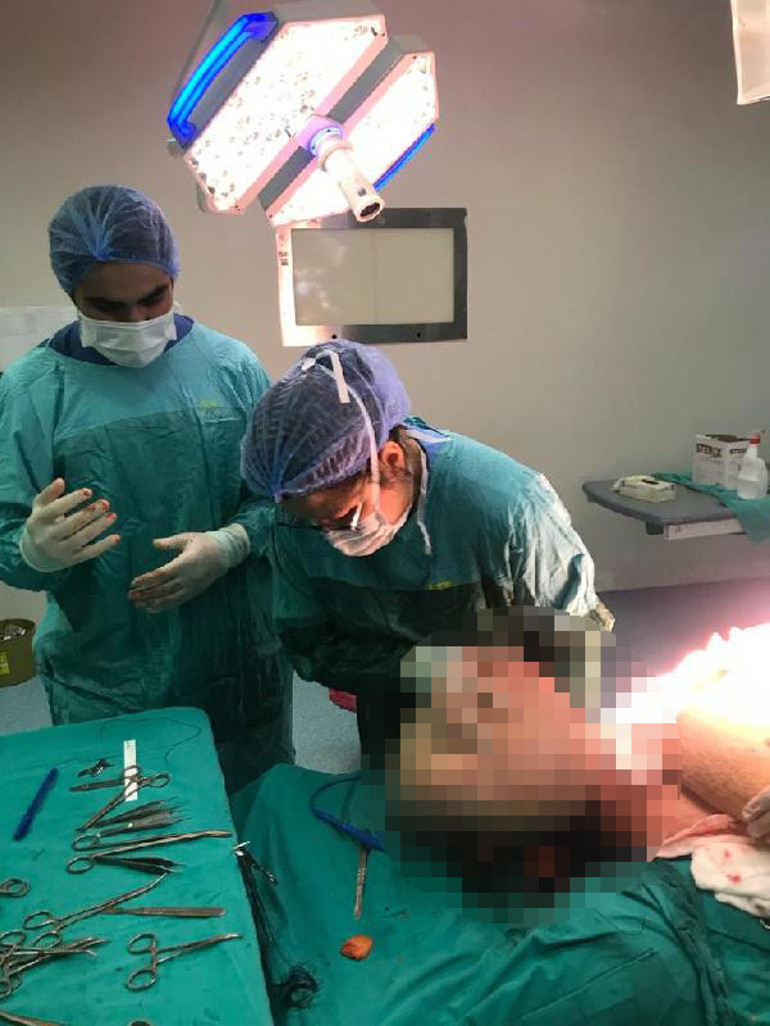 Yürümekte güçlük çekiyordu: 25 kilo yağ dokusu çıkarıldı