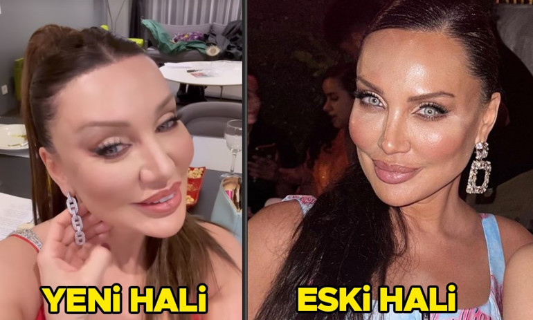 Son hali çok konuşulmuştu... Bengüden açıklama geldi