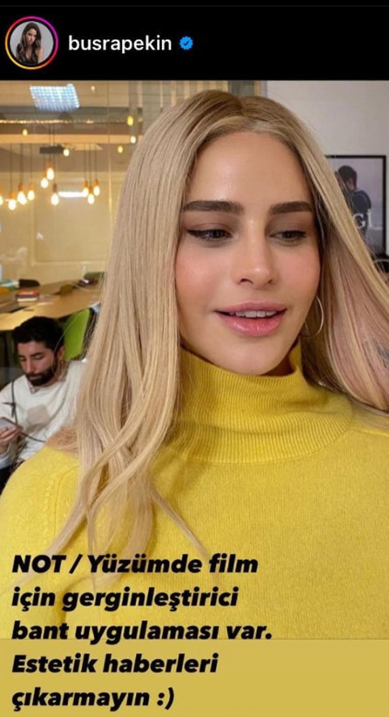 Son hali çok konuşulmuştu... Bengüden açıklama geldi