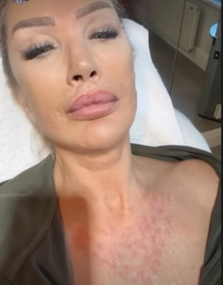 Son hali çok konuşulmuştu... Bengüden açıklama geldi