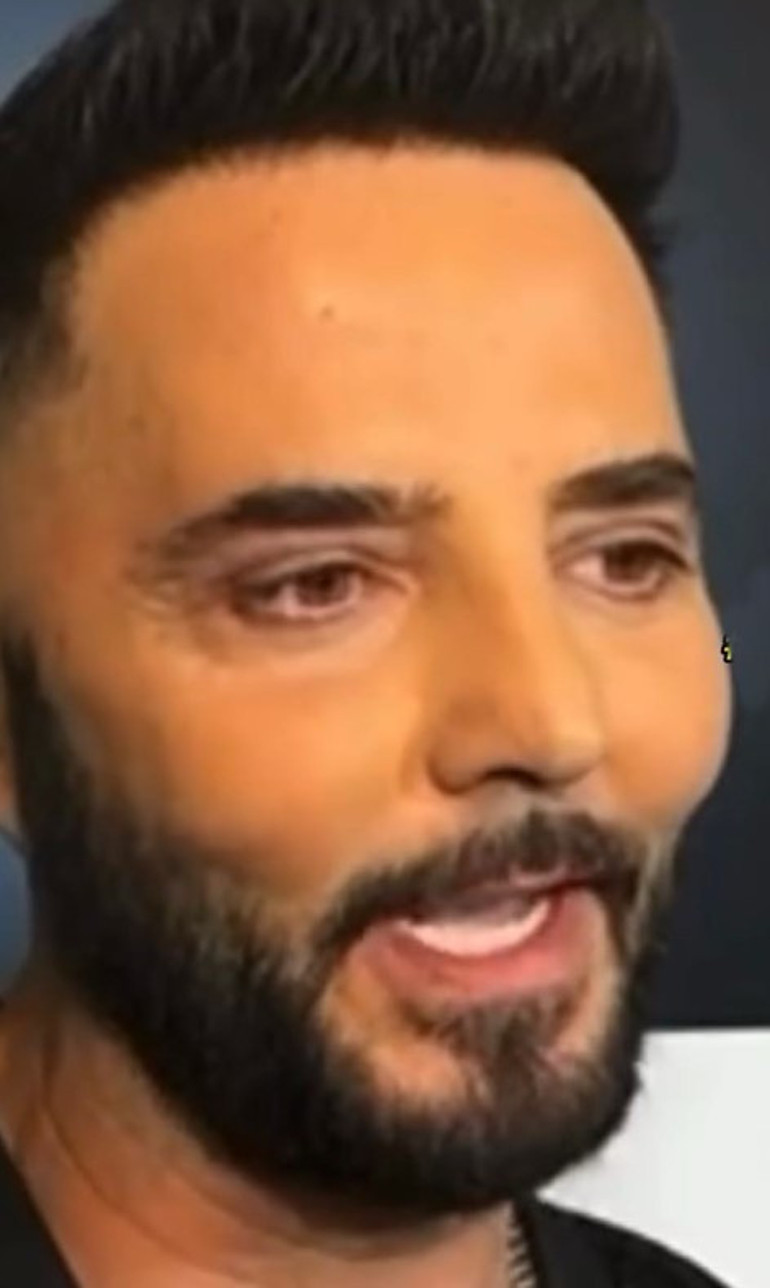 Son hali çok konuşulmuştu... Bengüden açıklama geldi