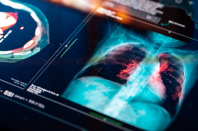 Diş hastalıkları kalp ve akciğer sağlığını tehdit ediyor Arada nasıl bir ilişki var İngiliz doktor uyardı: Arkadaşım neredeyse ölüyordu…