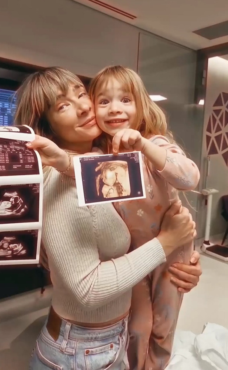 İtalyada evlenmişlerdi...Kaan Yıldırım bebeğinin cinsiyetini paylaştı