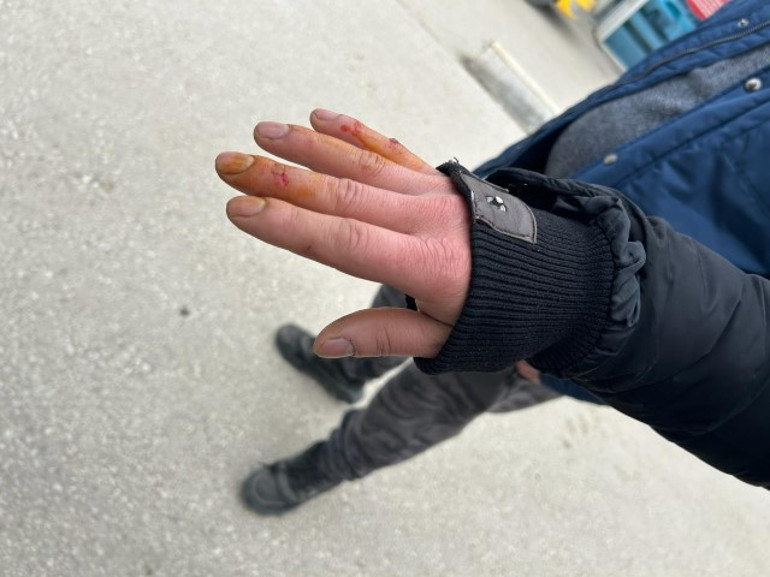 Sokak köpeği anne ve çocuklarına saldırdı: 4 yaralı