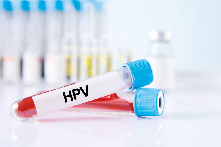 1-31 Ocak Rahim Ağzı Kanseri Farkındalık Ayı... HPV hakkında doğru bilinen yanlışlar
