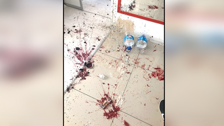 Mafya gibi ev sahibi... Kiracısını vurmak için adam tutmuş