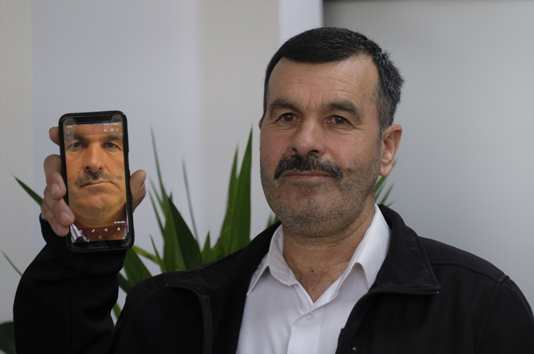 Çene ağrısı çekip, yüz asimetrileri bozulmuştu... Sebebini öğrenince hayatlarının şokunu yaşadılar: İnsan içine çıkamıyordum