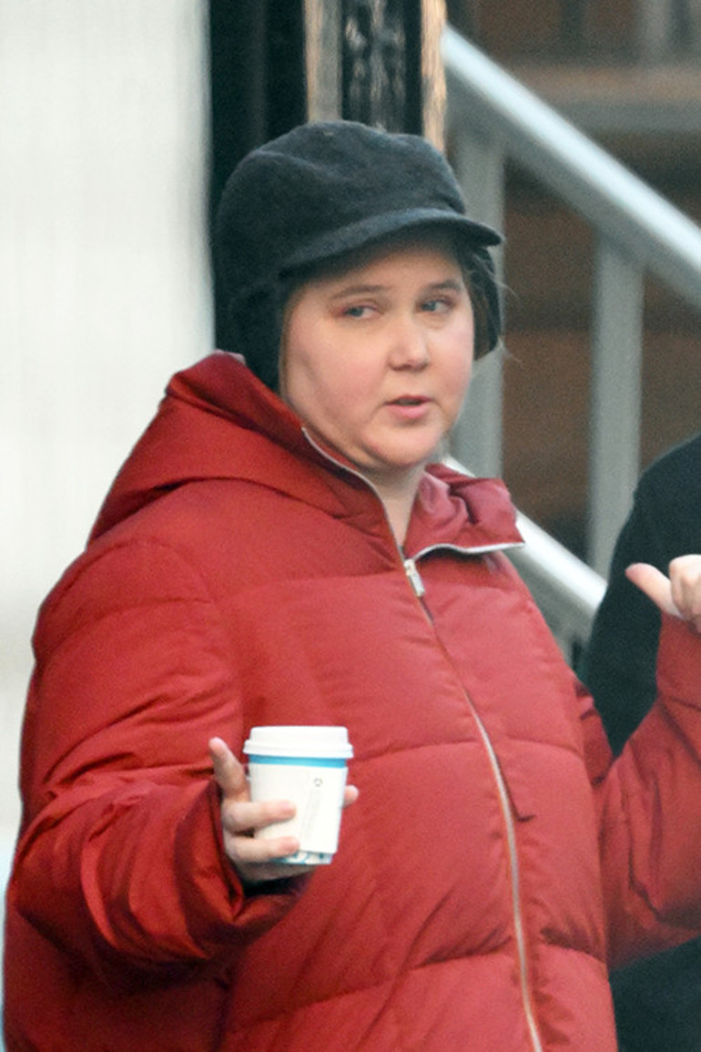 Herkes ünlü yıldızın yüzüyle alay etmişti: Altından ciddi bir hastalık çıktı