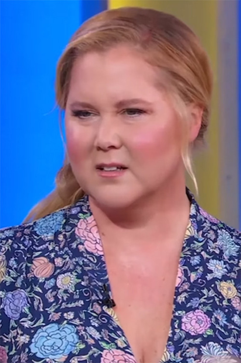 Herkes ünlü yıldızın yüzüyle alay etmişti: Altından ciddi bir hastalık çıktı