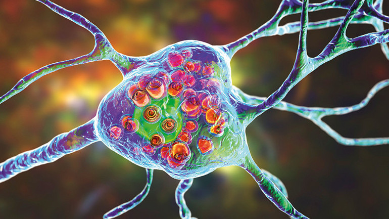 Teşhis edilmesi 7 yıl sürüyor