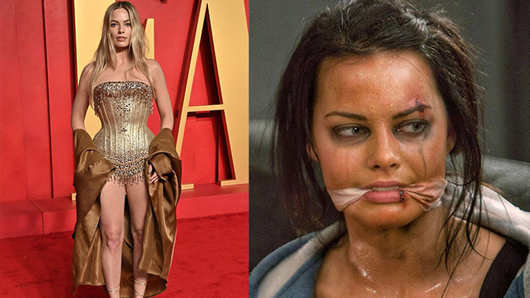 Bebek yüzlü yıldızı mercek altına aldılar: Yaptırdığı estetikleri tek tek saydılar