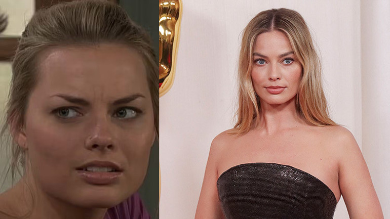 Bebek yüzlü yıldızı mercek altına aldılar: Yaptırdığı estetikleri tek tek saydılar