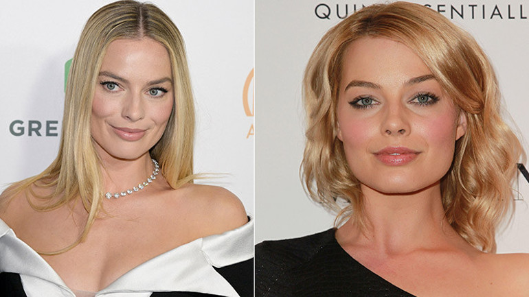 Bebek yüzlü yıldızı mercek altına aldılar: Yaptırdığı estetikleri tek tek saydılar