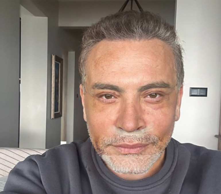 Ünlü şarkıcı tanınmaz halde...Nerelerdesin diye sorup duruyordunuz