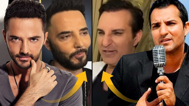 Ünlü şarkıcı tanınmaz halde...Nerelerdesin diye sorup duruyordunuz