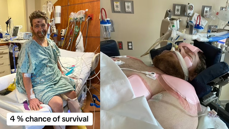 Bacağındaki kılları almaya çalışırken canından oluyordu Günlerce komada kaldı, doktorlar yaşaması için yüzde 4 şans verdi
