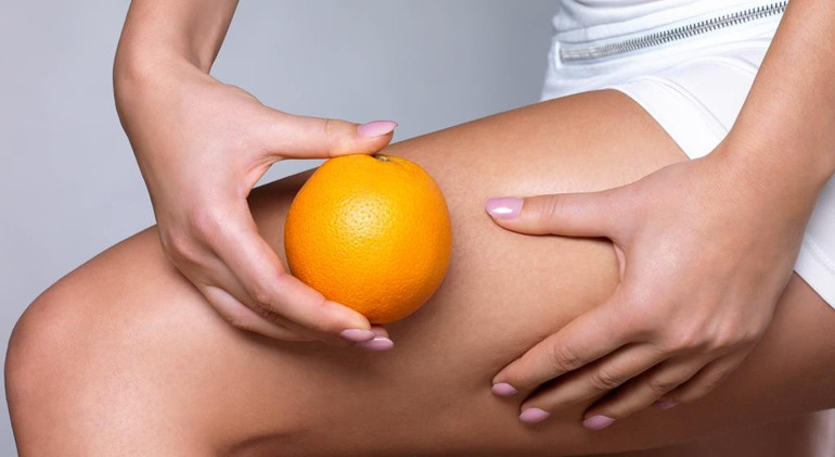 Selülitten kurtulmak mümkün mü