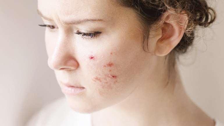 Mikroplastikleri damardan da almaya başlamışız