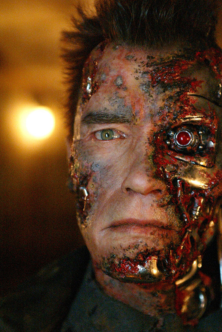 Daha önce üç kez ameliyat olmuştu… ‘Terminatör’ Arnold Schwarzenegger’e kalp pili takıldı: Artık tam bir makineyim