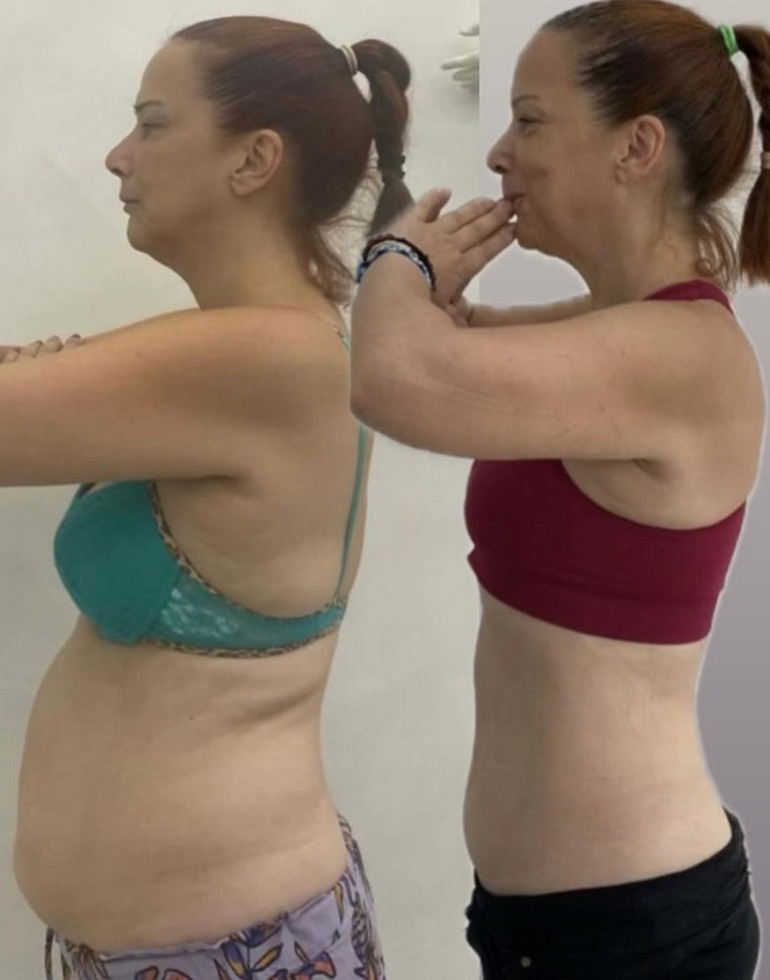 10 kilo veren Demet Akalın karın kaslarını sergiledi